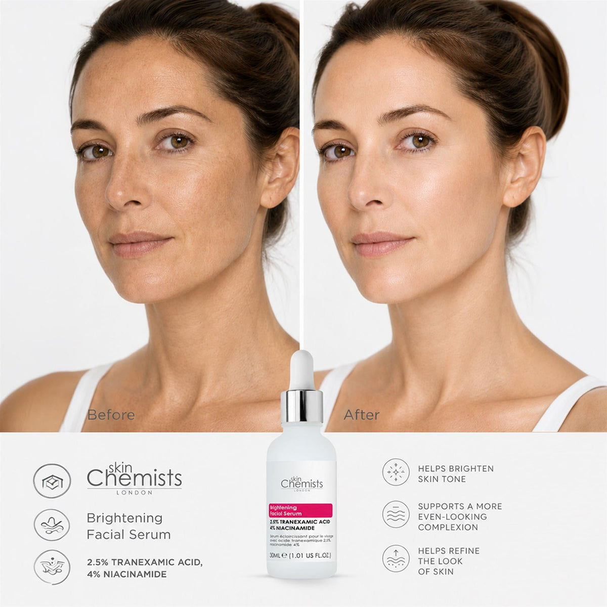 Sérum facial iluminador con ácido tranexámico al 2,5%, ácido tranexámico al 2,5% y niacinamida al 4% 30ml