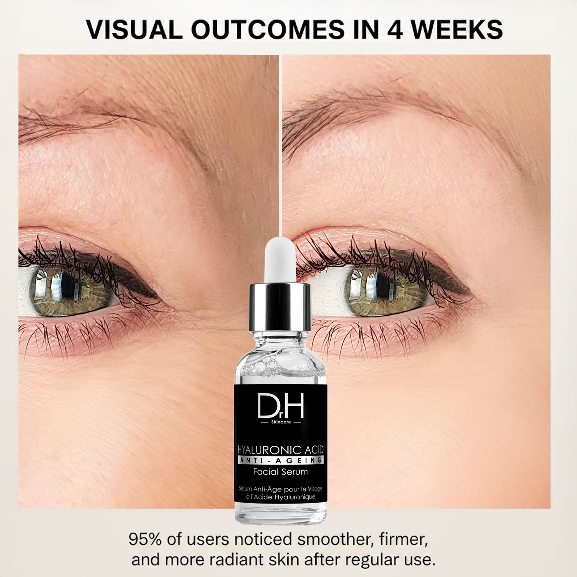 Anti-Aging Hyaluronsäure-Gesichtsserum 30 ml