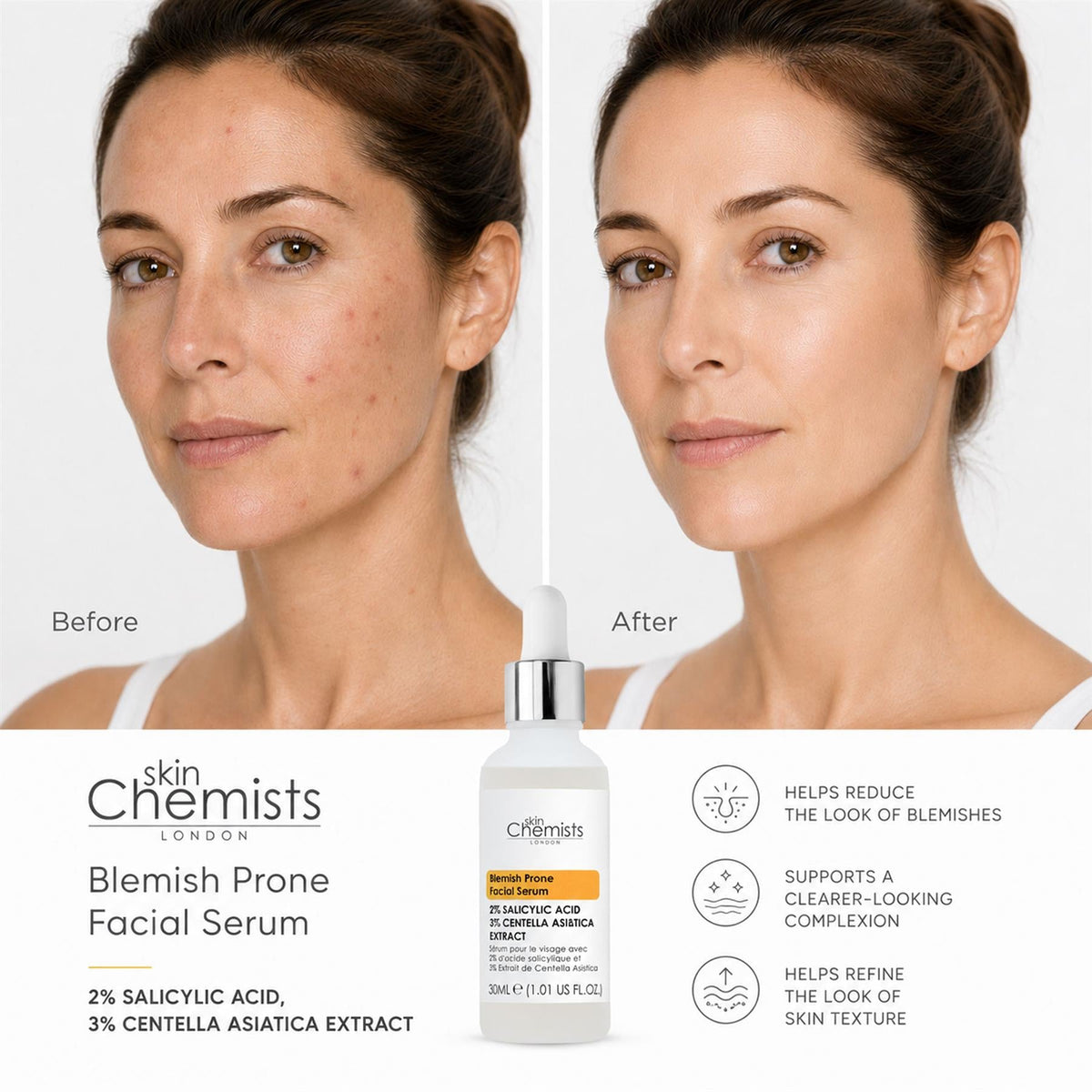 Sérum facial para pieles con tendencia a las imperfecciones con ácido salicílico al 2% y Centella asiatica al 3% 30ml
