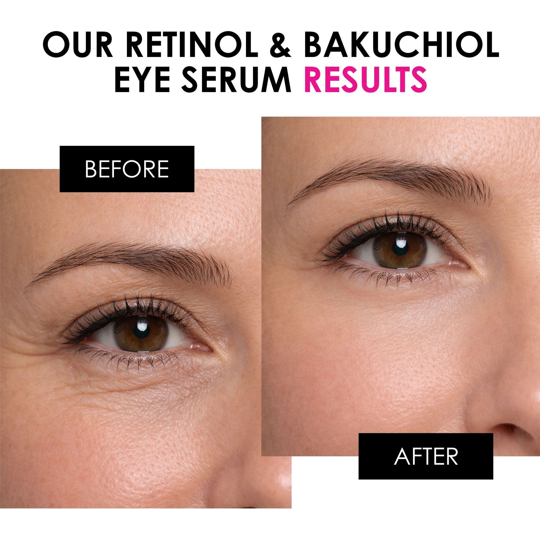 Youth Series Retinol &amp; Bakuchiol Augenserum 15 ml