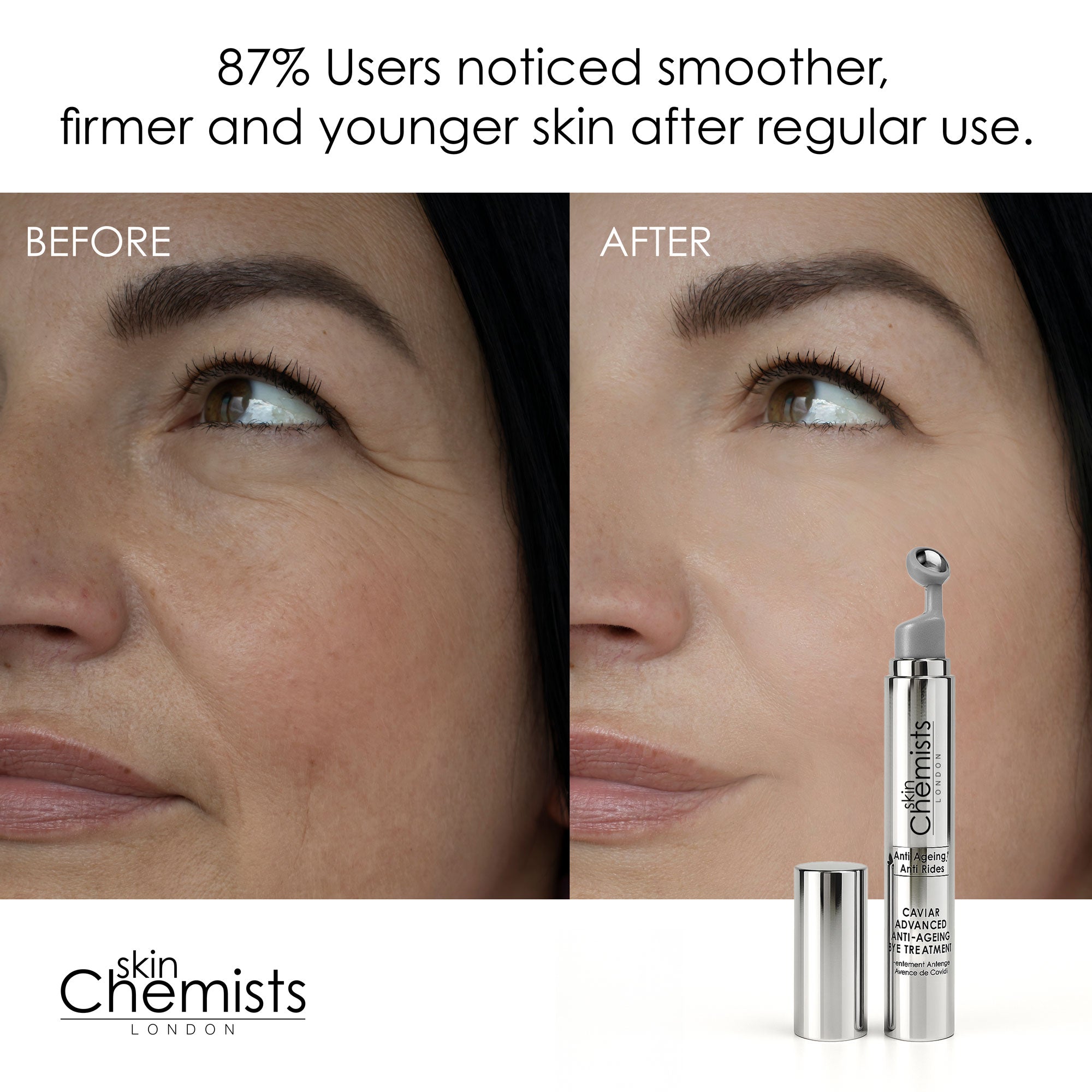 Caviar Advanced Anti-Aging Augenpflege 15 ml