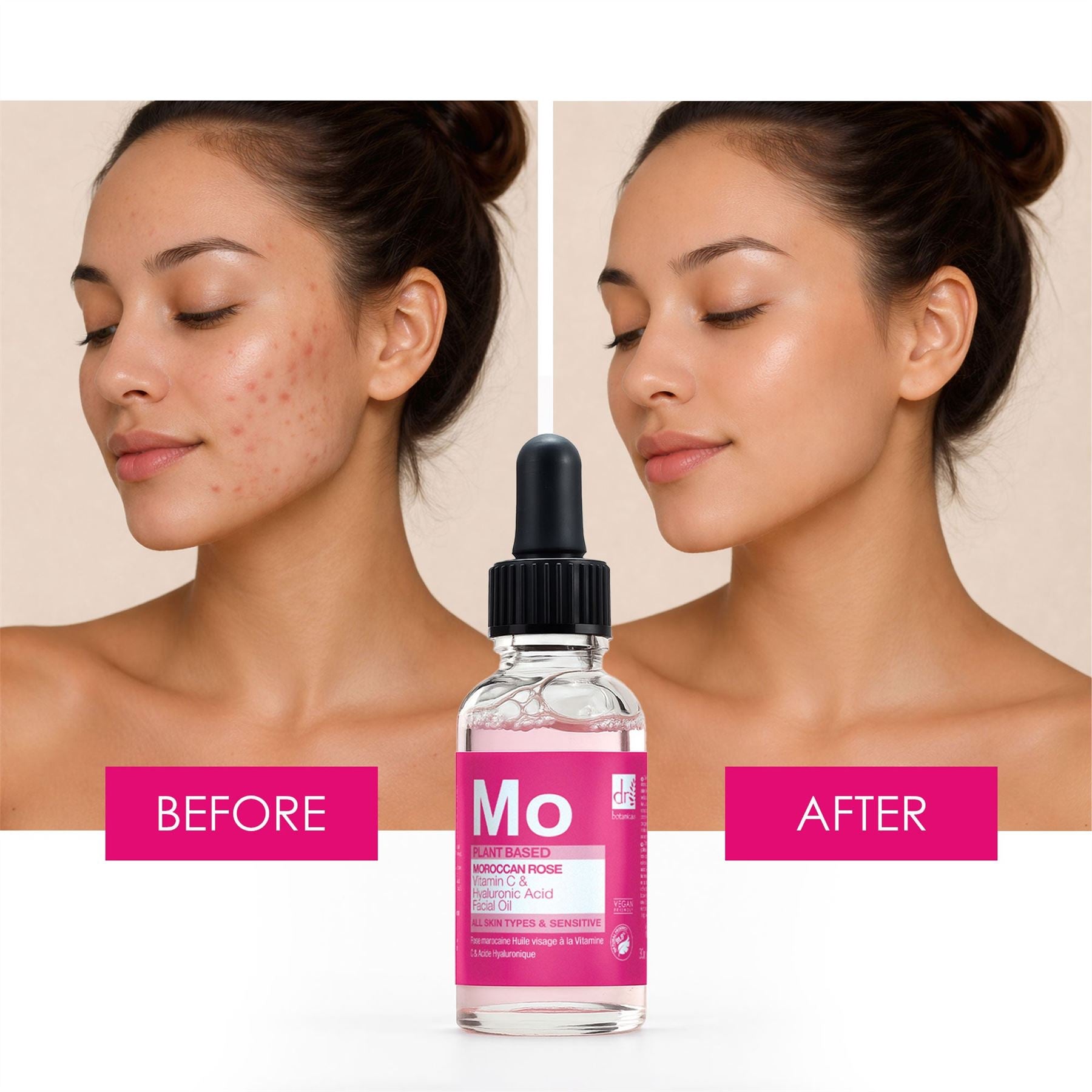 Huile visage à la rose marocaine, à l'acide hyaluronique et à la vitamine C, 30 ml