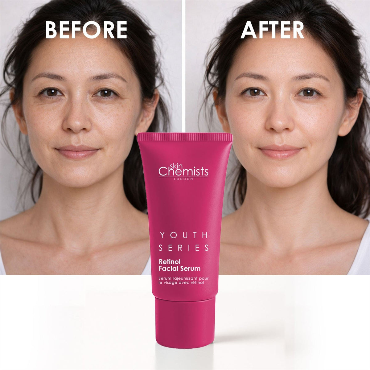 Retinol Facial Serum 30ml - skinChemists
